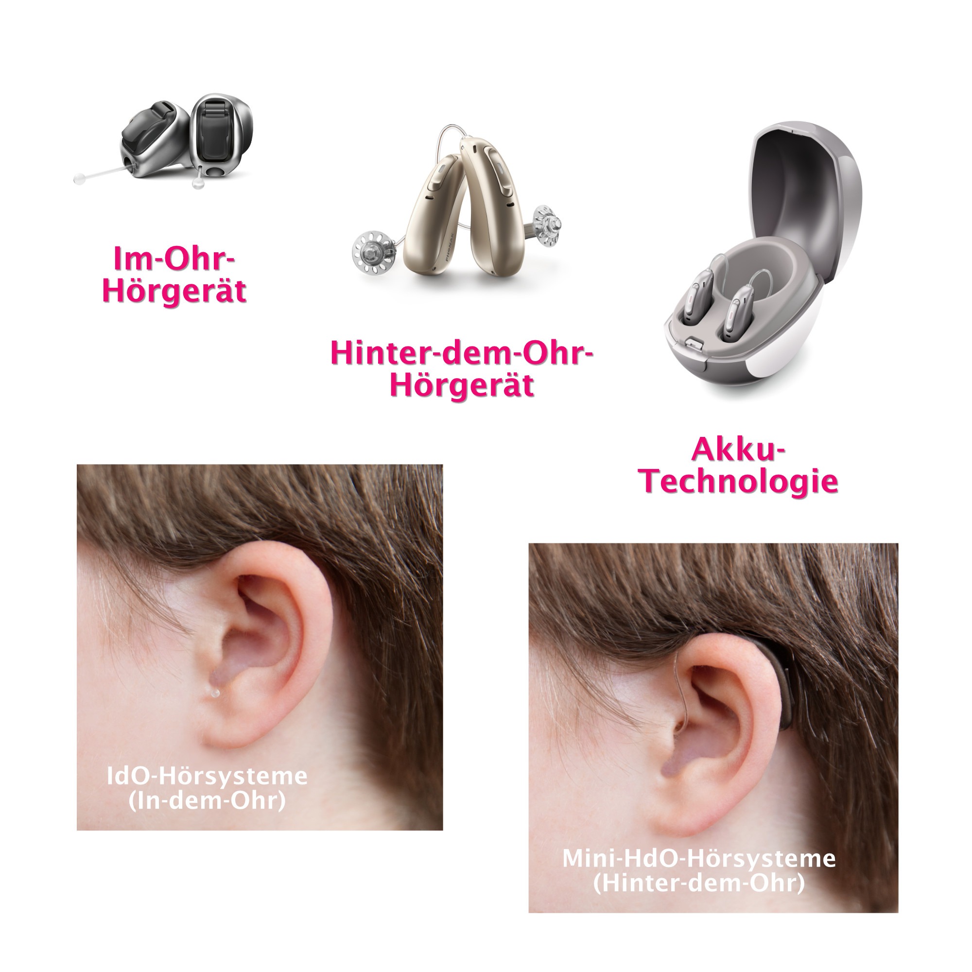 Vergleichsbilder zwischen Im-Ohr-Hörgerät, Hinter-dem-Ohr-Hörgerät und Akku-Technologie Hörgerät.
